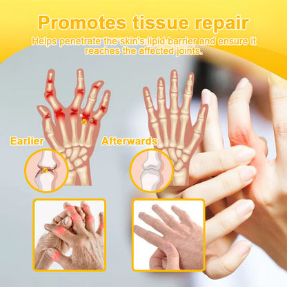 TLOPA® Botulinum Toxin & Bee Venom Pain-Relief Bone Healing Cream❤️