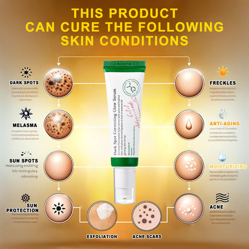 Dark Spot Correcting Glow Serum 50ml / 1.69 fl. oz | Brightening Serum, Dark Spot Treatment, Hyperpigmentation Treatment💚