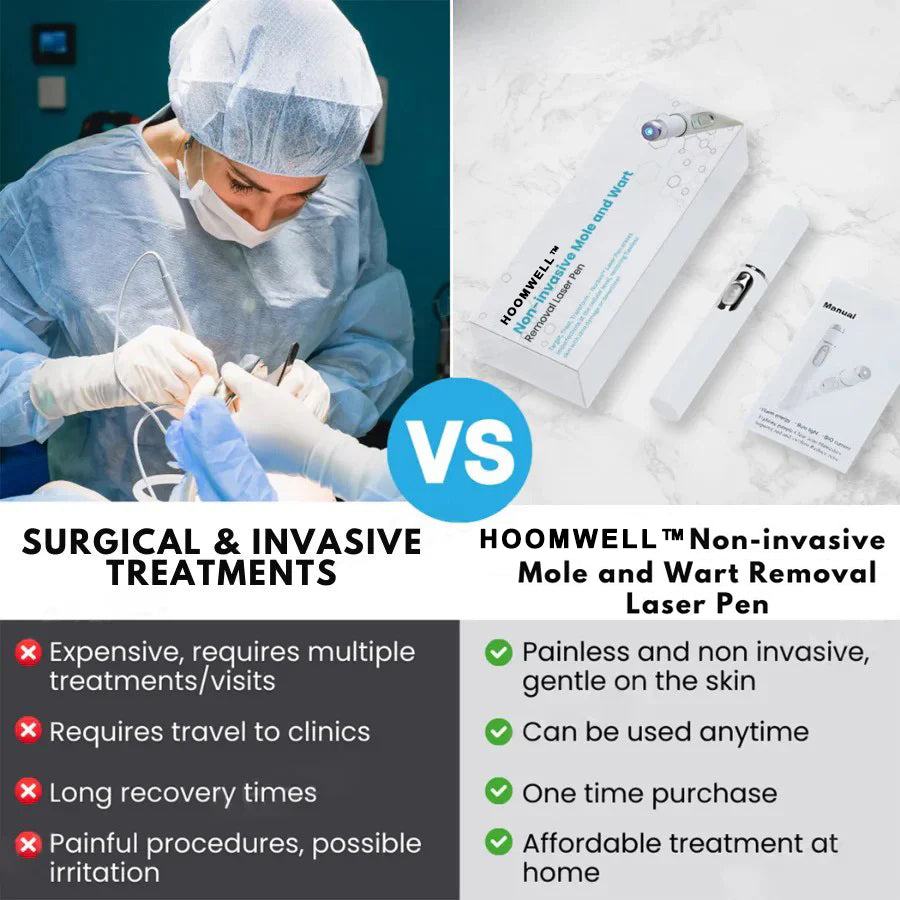 🔥【OFFICIAL STORE】HOOMWELL™ Non-Invasive Mole and Wart Removal Laser Pen