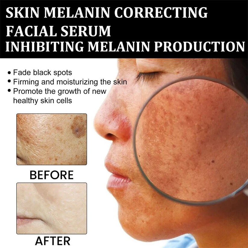 Dark Spot Correcting Glow Serum 50ml / 1.69 fl. oz | Brightening Serum, Dark Spot Treatment, Hyperpigmentation Treatment💚