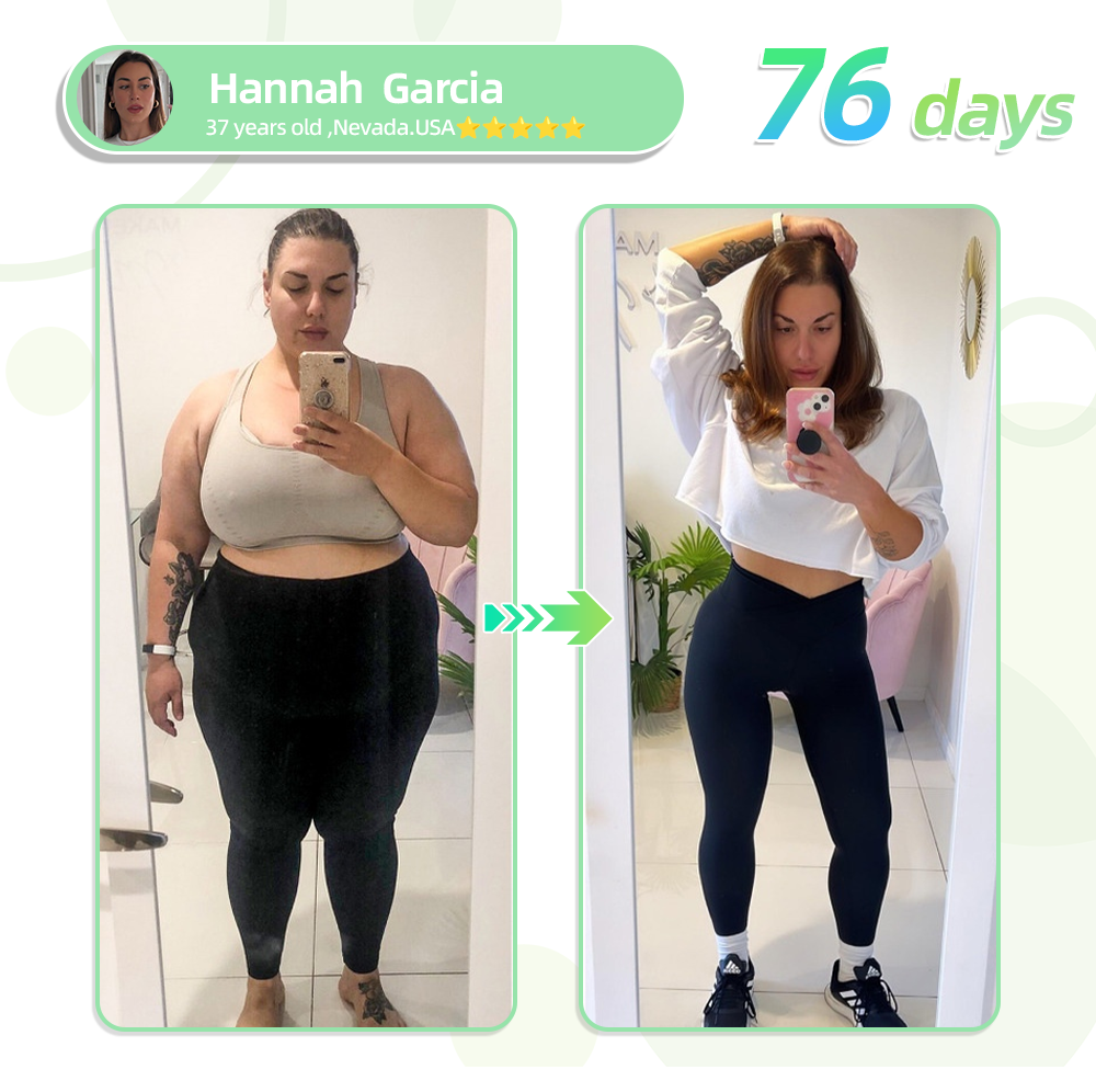 HOOMWELL™ GLP-1 Slimming Patch – Burn Fat Without Pills