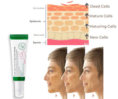 Dark Spot Correcting Glow Serum 50ml / 1.69 fl. oz | Brightening Serum, Dark Spot Treatment, Hyperpigmentation Treatment💚