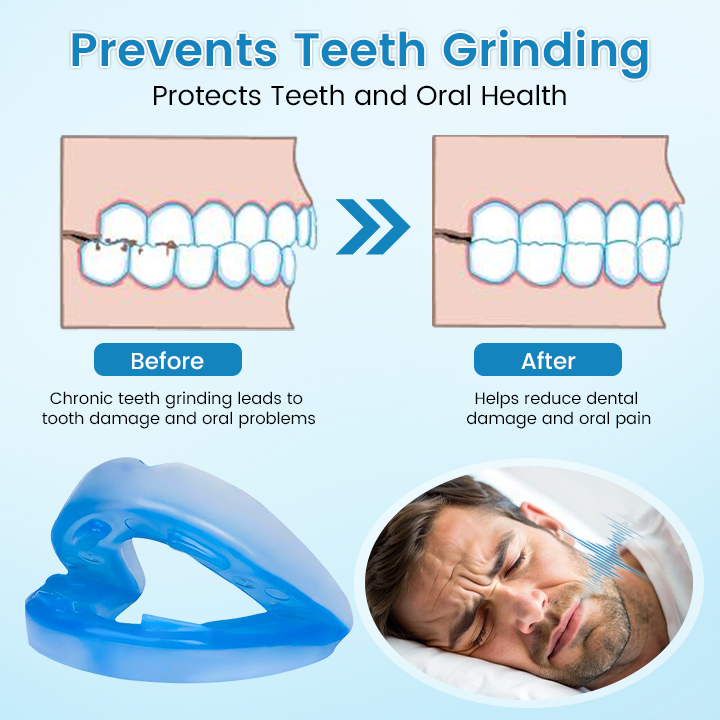 ✨[Official Brand Store]  Flanora® Adjustable Anti-Snoring Mouthpiece Universal Size
