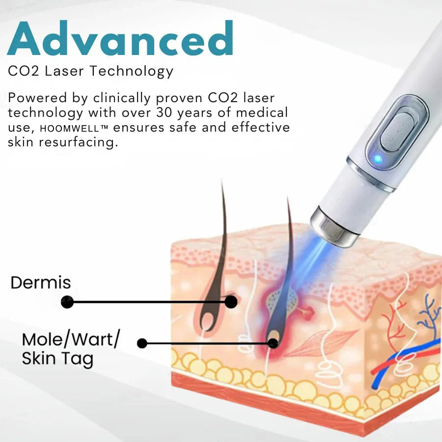 🔥【OFFICIAL STORE】HOOMWELL™ Non-Invasive Mole and Wart Removal Laser Pen