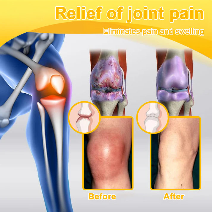 TLOPA® Botulinum Toxin & Bee Venom Pain-Relief Bone Healing Cream❤️