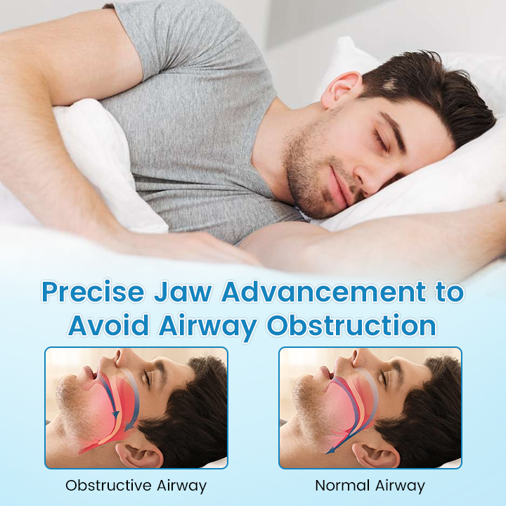 ✨[Official Brand Store]  Flanora® Adjustable Anti-Snoring Mouthpiece Universal Size