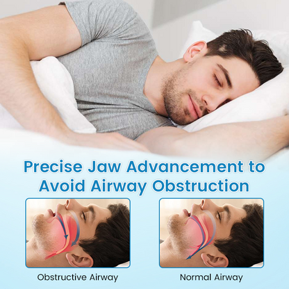 ✨[Official Brand Store]  Flanora® Adjustable Anti-Snoring Mouthpiece Universal Size