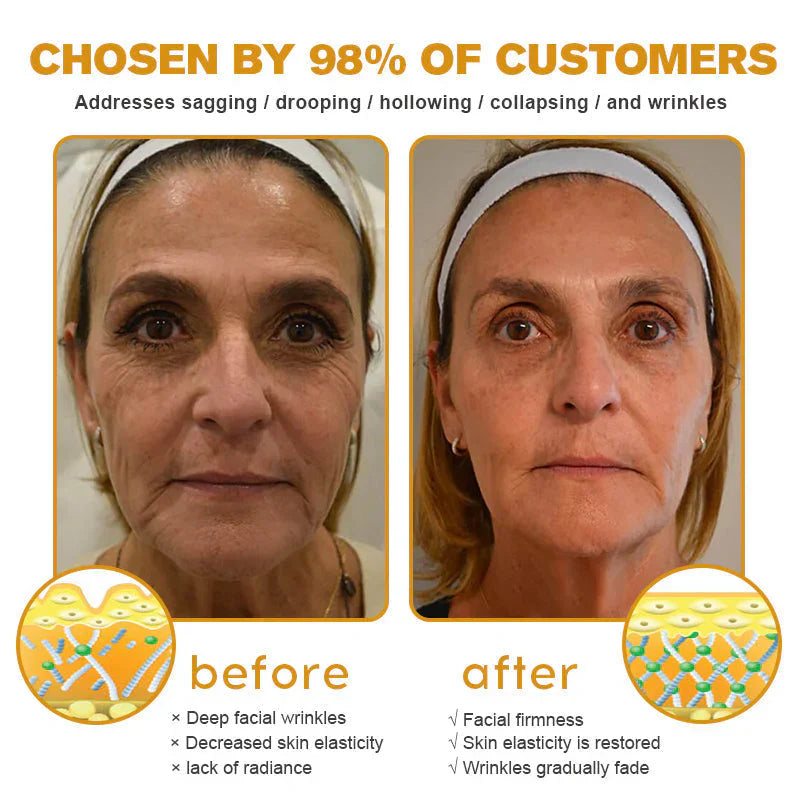 HOOMWELL™Botox Bee Venom Wrinkle Removal Cream