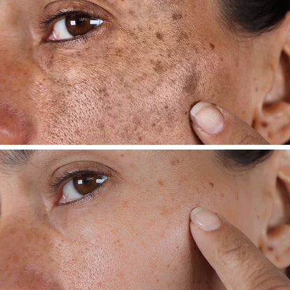 Dark Spot Correcting Glow Serum 50ml / 1.69 fl. oz | Brightening Serum, Dark Spot Treatment, Hyperpigmentation Treatment💚