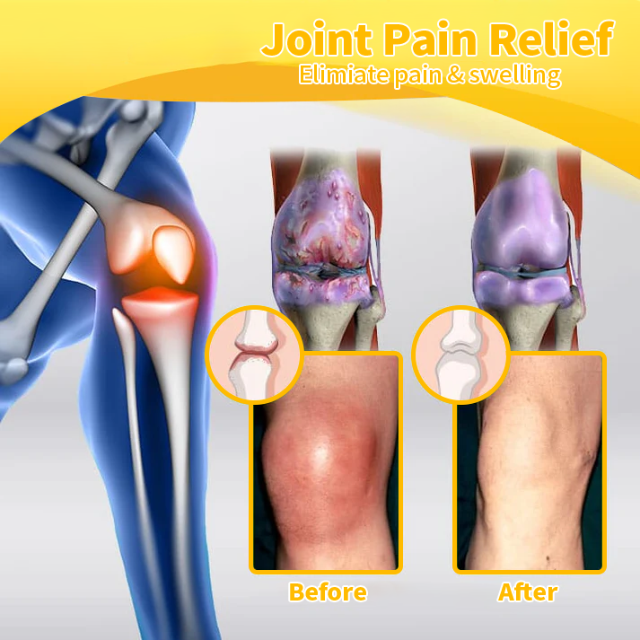 HOOMWELL™ Bee Venom Advanced Joint and Bone Healing Cream  (New Zealand Bee Extract - specializing in orthopedic conditions)