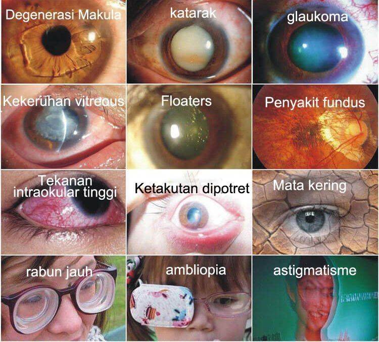 ⏰FLASH SALE: 69% OFF🔥— Japan Vision Drops — Rapidly Heals All Eye Conditions & Restores Vision
