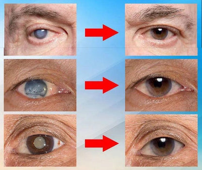 ⏰FLASH SALE: 69% OFF🔥— Japan Vision Drops — Rapidly Heals All Eye Conditions & Restores Vision